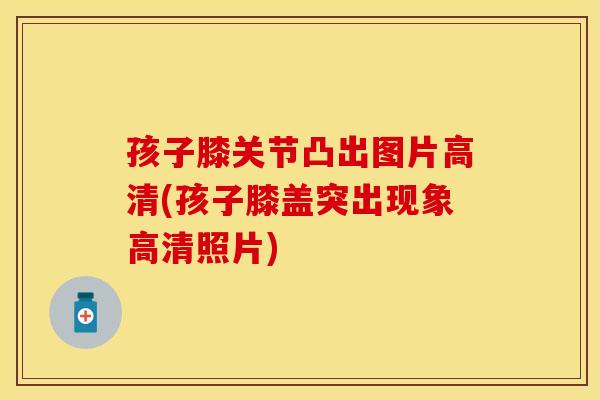 孩子膝关节凸出图片高清(孩子膝盖突出现象高清照片)
