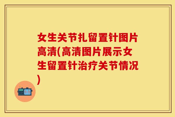 女生关节扎留置针图片高清(高清图片展示女生留置针治疗关节情况)