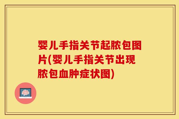 婴儿手指关节起脓包图片(婴儿手指关节出现脓包血肿症状图)