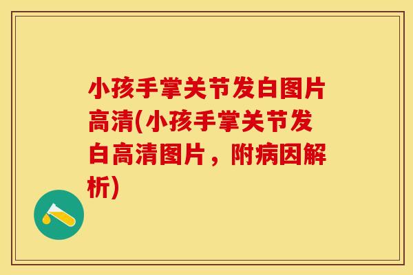 小孩手掌关节发白图片高清(小孩手掌关节发白高清图片,附因解析) 小孩手掌关节发白图片高清(小孩手掌关节发白高清图片,附因解析)