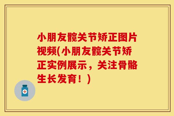 小朋友髋关节矫正图片视频(小朋友髋关节矫正实例展示，关注骨骼生长发育！)