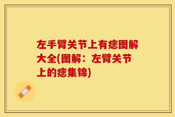 左手臂关节上有痣图解大全(图解：左臂关节上的痣集锦)