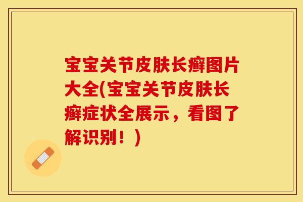 宝宝关节长癣图片大全(宝宝关节长癣症状全展示,看图了解识别!) 宝宝关节长癣图片大全(宝宝关节长癣症状全展示,看图了解识别!)