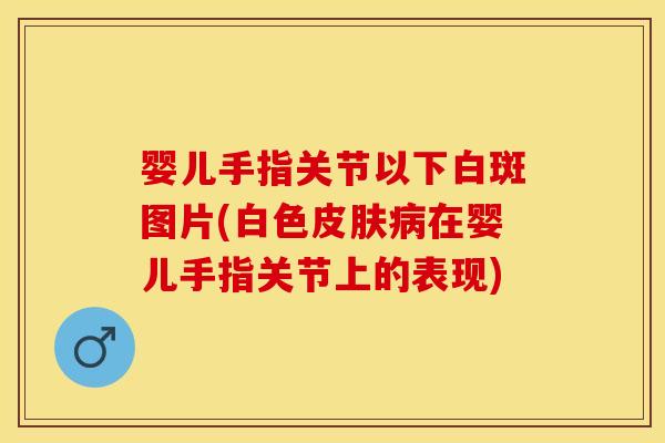 婴儿手指关节以下白斑图片(白色皮肤病在婴儿手指关节上的表现)
