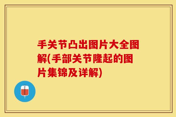 手关节凸出图片大全图解(手部关节隆起的图片集锦及详解)
