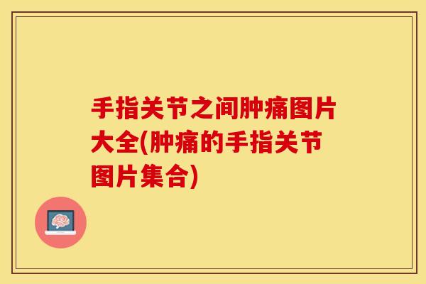 手指关节之间肿痛图片大全(肿痛的手指关节图片集合) 手指关节之间肿痛图片大全(肿痛的手指关节图片集合)