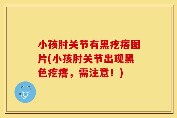 小孩肘关节有黑疙瘩图片(小孩肘关节出现黑色疙瘩,需注意!) 小孩肘关节有黑疙瘩图片(小孩肘关节出现黑色疙瘩,需注意!)