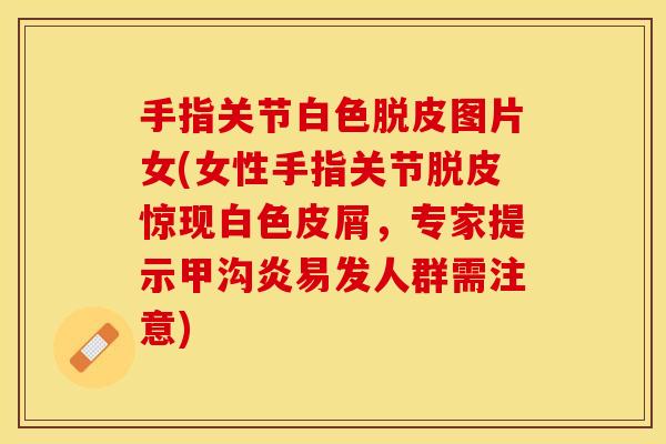 手指关节白色脱皮图片女(女性手指关节脱皮惊现白色皮屑，专家提示甲沟炎易发人群需注意)