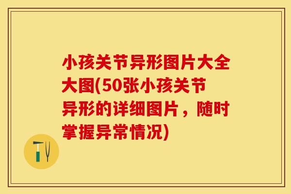 小孩关节异形图片大全大图(50张小孩关节异形的详细图片，随时掌握异常情况)