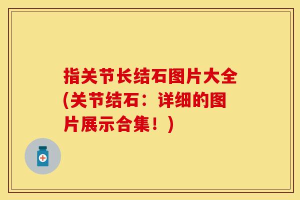 指关节长结石图片大全(关节结石：详细的图片展示合集！)