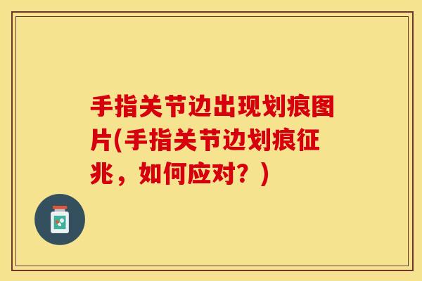 手指关节边出现划痕图片(手指关节边划痕征兆，如何应对？)