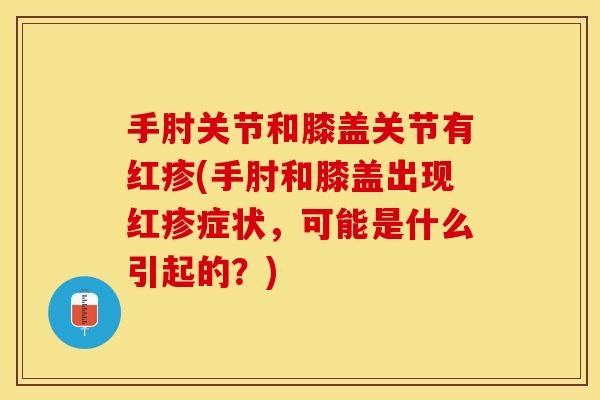 手肘关节和膝盖关节有红疹(手肘和膝盖出现红疹症状，可能是什么引起的？)