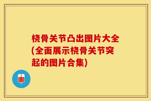 桡骨关节凸出图片大全(全面展示桡骨关节突起的图片合集)