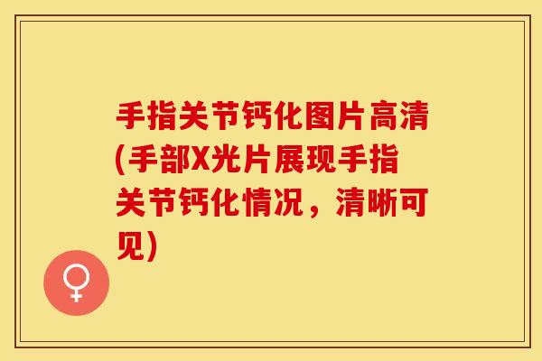 手指关节钙化图片高清(手部X光片展现手指关节钙化情况，清晰可见)