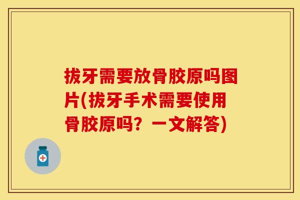 拔牙需要放骨胶原吗图片(拔牙手术需要使用骨胶原吗？一文解答)