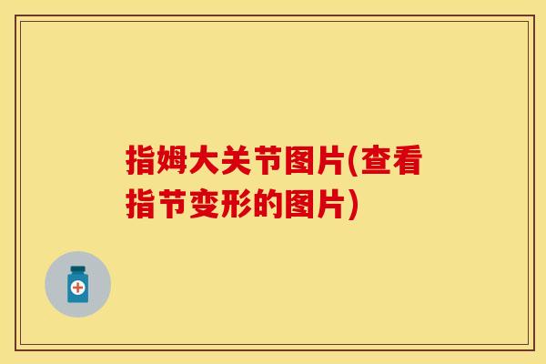 指姆大关节图片(查看指节变形的图片)