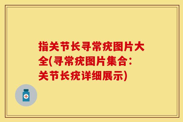 指关节长寻常疣图片大全(寻常疣图片集合：关节长疣详细展示)