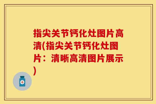 指尖关节钙化灶图片高清(指尖关节钙化灶图片：清晰高清图片展示)