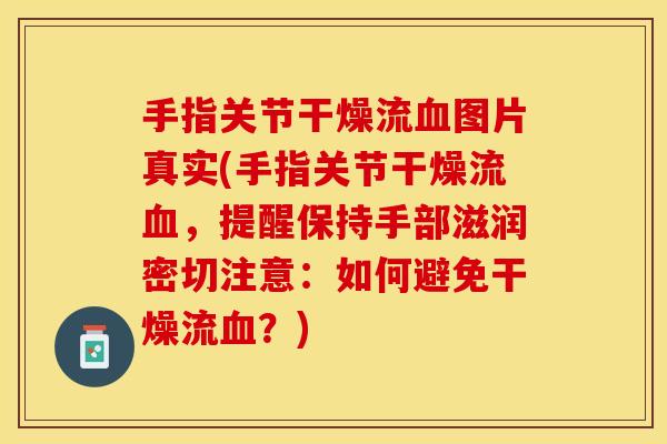 手指关节干燥流血图片真实(手指关节干燥流血，提醒保持手部滋润密切注意：如何避免干燥流血？)