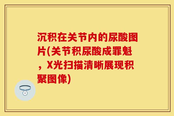 沉积在关节内的尿酸图片(关节积尿酸成罪魁,X光扫描清晰展现积聚图像) 沉积在关节内的尿酸图片(关节积尿酸成罪魁,X光扫描清晰展现积聚图像)