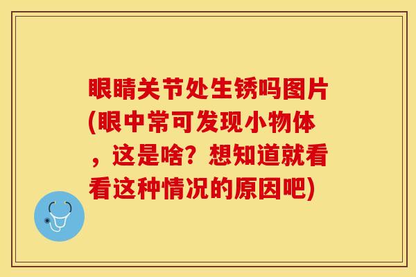 眼睛关节处生锈吗图片(眼中常可发现小物体，这是啥？想知道就看看这种情况的原因吧)