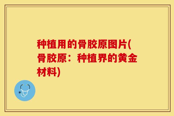 种植用的骨胶原图片(骨胶原：种植界的黄金材料)