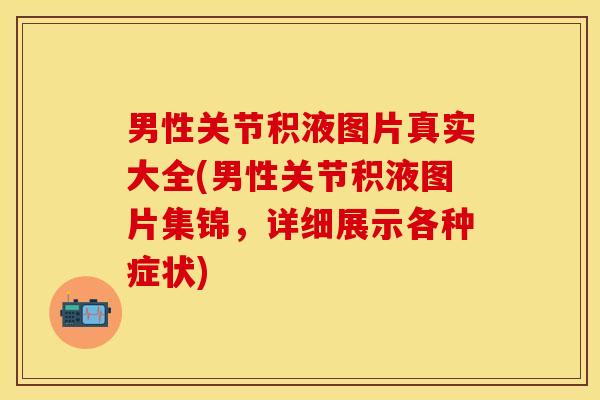 男性关节积液图片真实大全(男性关节积液图片集锦，详细展示各种症状)