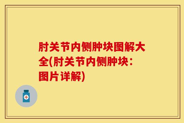 肘关节内侧肿块图解大全(肘关节内侧肿块：图片详解)