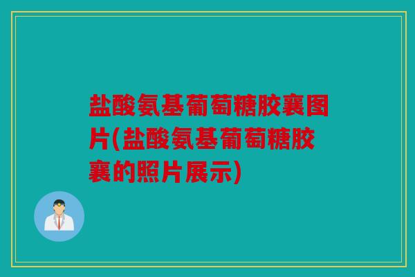 盐酸氨基葡萄糖胶襄图片(盐酸氨基葡萄糖胶襄的照片展示)