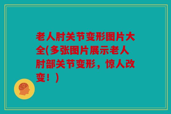 老人肘关节变形图片大全(多张图片展示老人肘部关节变形，惊人改变！)