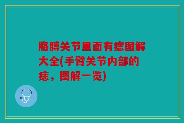 胳膊关节里面有痣图解大全(手臂关节内部的痣，图解一览)