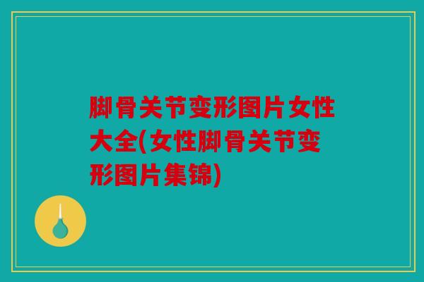 脚骨关节变形图片女性大全(女性脚骨关节变形图片集锦) 脚骨关节变形图片女性大全(女性脚骨关节变形图片集锦)