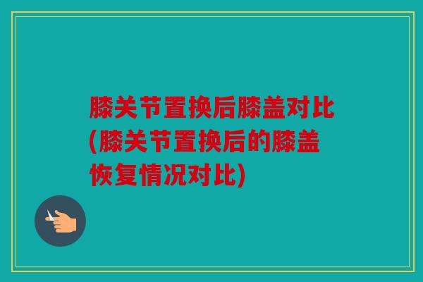 膝关节置换后膝盖对比(膝关节置换后的膝盖恢复情况对比)