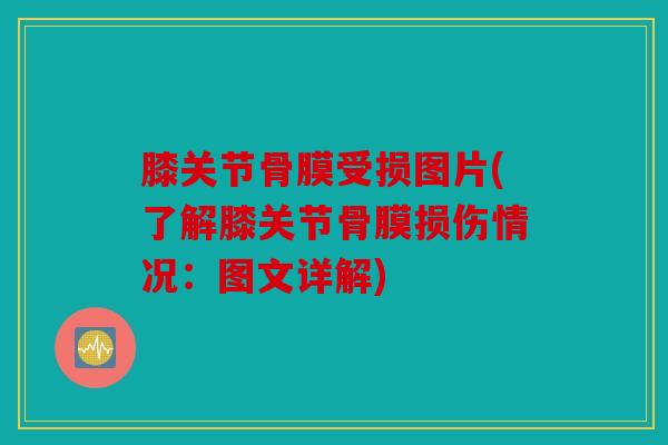 膝关节骨膜受损图片(了解膝关节骨膜损伤情况:图文详解) 膝关节骨膜受损图片(了解膝关节骨膜损伤情况:图文详解)