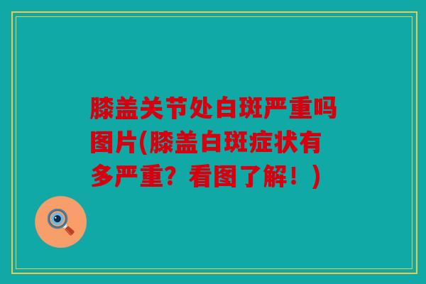 膝盖关节处白斑严重吗图片(膝盖白斑症状有多严重？看图了解！)